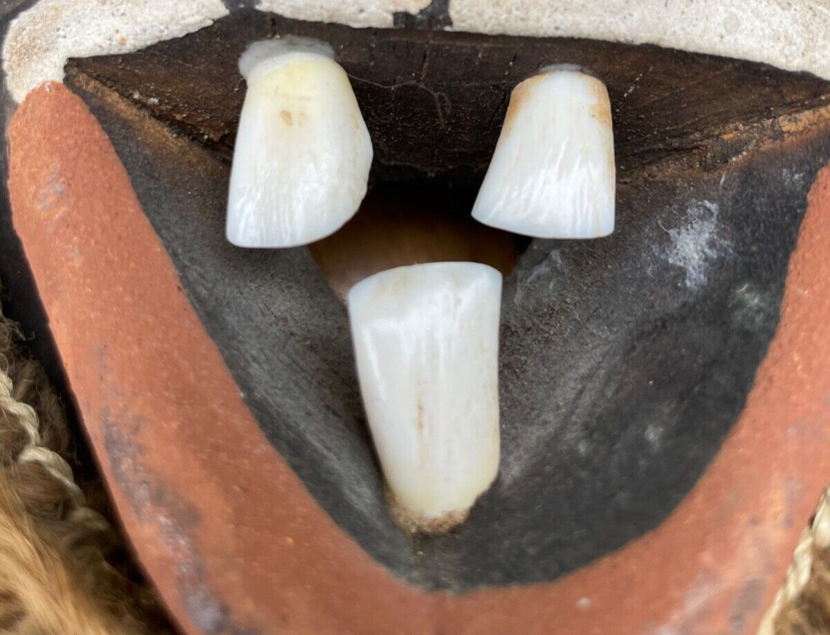 45859840